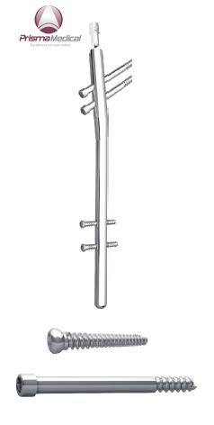 Haste Bloqueada Proximal Femoral